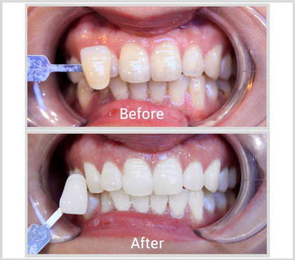 Slider image (6) Home Dental Clinic